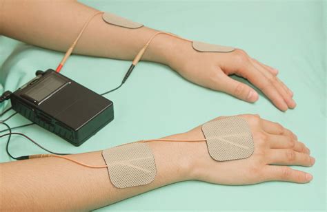 Will Electrical Stimulation Help Me Recover From Stroke?