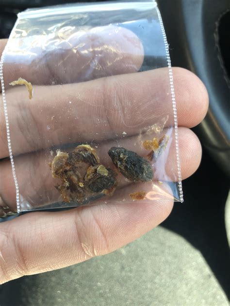 The earwax I got extracted today. It's 25 years old. : r/oddlyterrifying