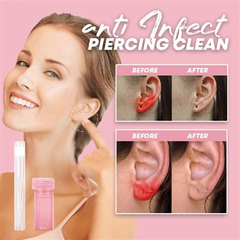 15ml Ear Hole Cleaning Kit,ear Line Cleaning Ear Cavity Liquid ...