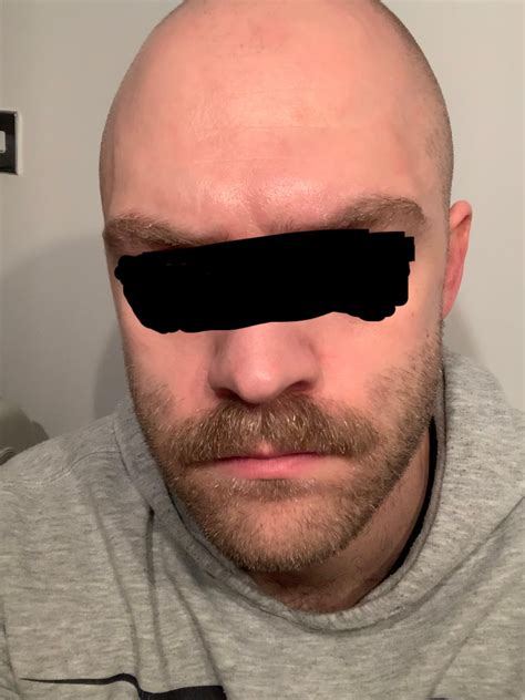 Does this look work (bald and moustache, with stubble)? : r/Moustache