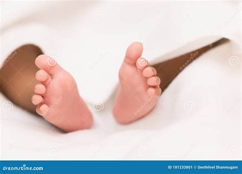 What Is Bow Legged Baby at Earl Sigala blog