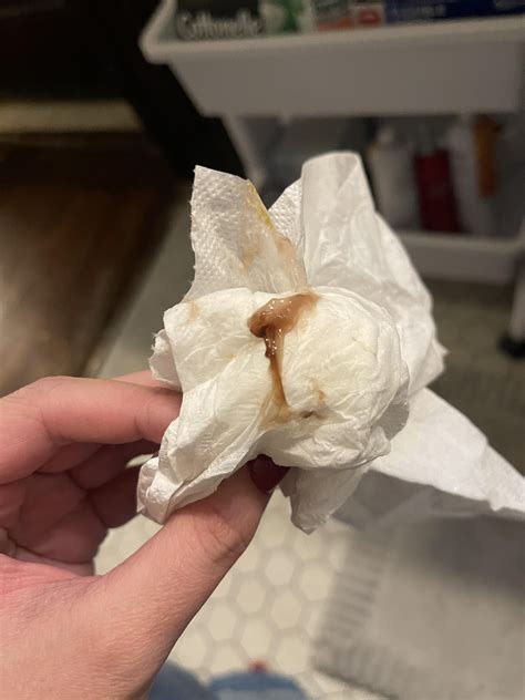 Implantation Bleeding And Mucus Periods V/S Pregnancy Bleeding