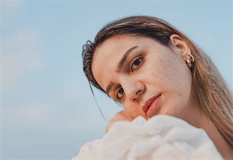 Sun, Sweat and Summer Acne - CellDerma