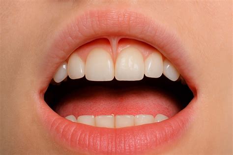 What is a frenulum and when is surgery required? - Lavin Dental Clinic