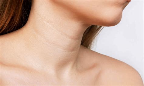 Dermatology-Designed Ways to Treat Neck Wrinkles at Home | Software