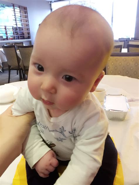 Baby lost hair and always shakes head side to side while sleeping