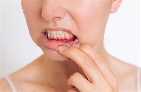 Is Gum Disease Contagious? | Ancaster, ON