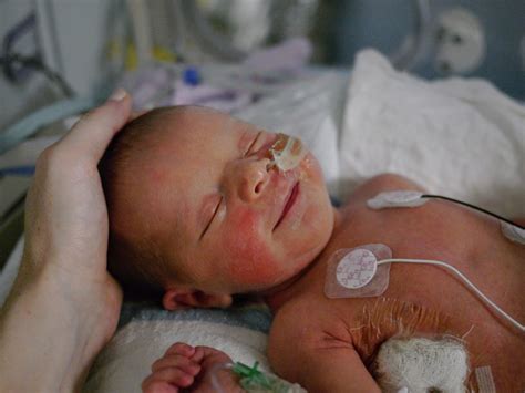 Spiritual Meaning Of Premature Birth