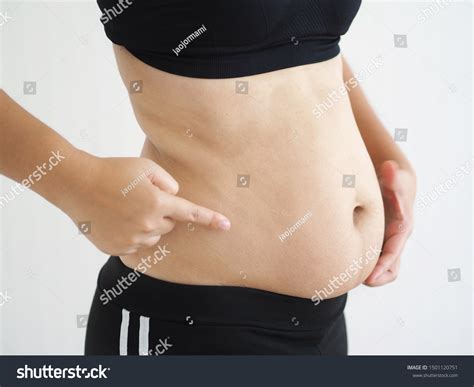 Cellulite Stomach Area