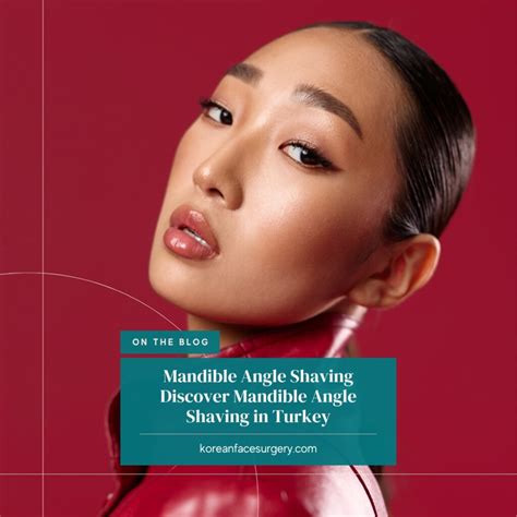 Mandible Angle Shaving - Korean Face Surgery