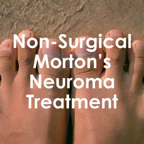 Morton's Neuroma Treatment at Ravenswood Chiropractic in Chicago