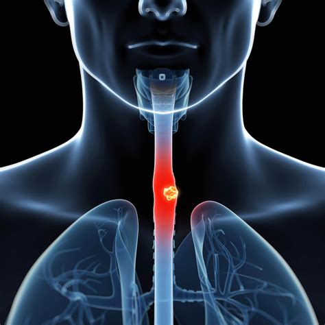 Minimally Invasive & Endoscopic Surgery | HK Surgeon