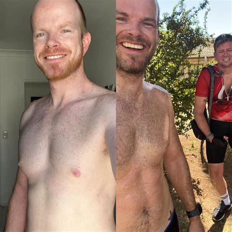 50 Weeks on Melanotan2. Used to be Type 1 and never able to tan. Have ...