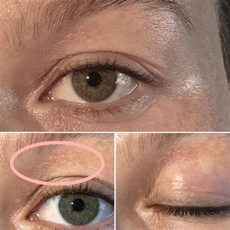 Eye Cream For Very Dry Eyelids at Elaine Sanchez blog