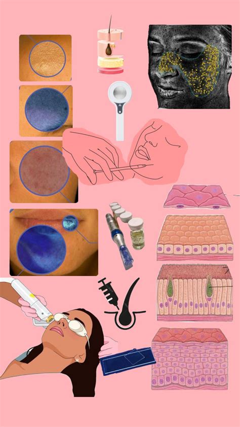 Dermatology | Dermatology career, Dermatology nurse, Diy pedicure