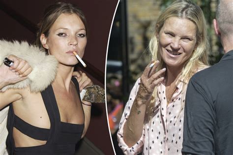 Kate Moss and smoking: How cigarettes can ruin your looks