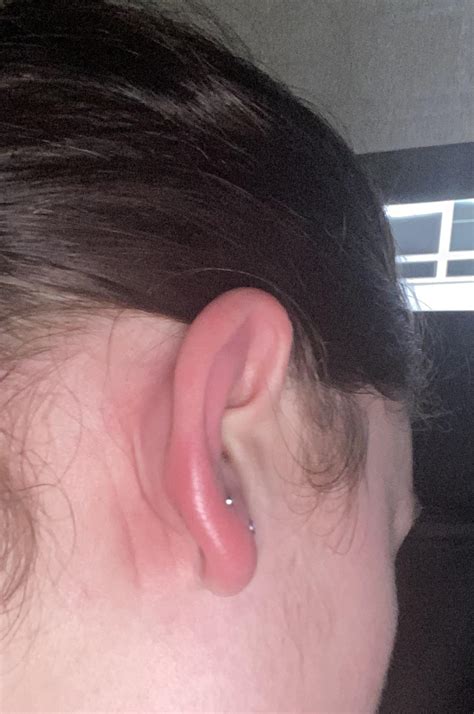 Ear Lobe Holes Earrings Too Big For Hole In Ear Online