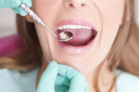 Can You Reverse Gum Disease? | Yardley Dentist