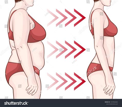 2,168 Before After Legs Weight Loss Images, Stock Photos & Vectors ...
