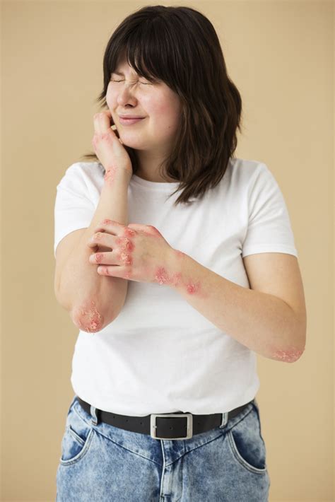 Wasp Sting Vinegar: How to Treat a String at Home - Welzo