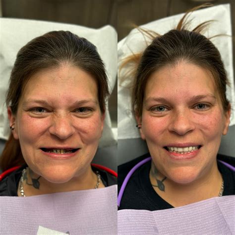 Brushy Creek Dentistry (@brushycreekdentistry) • Instagram photos and ...