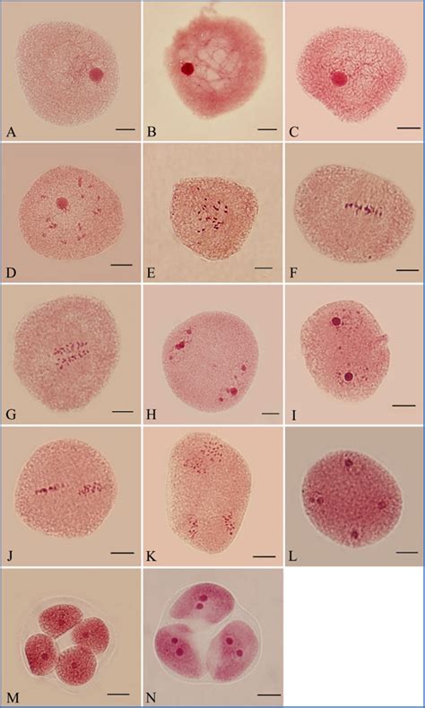 Anaphase 1 Of Meiosis Under Microscope Micropedia
