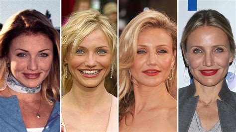 Cameron Diaz Plastic Surgery: Transformation Photos | Life & Style