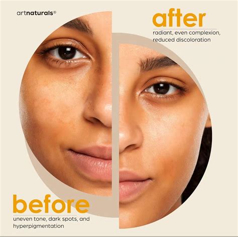 Kojic Acid Soap + African Net Soap (2 pack) - Artnaturals-store