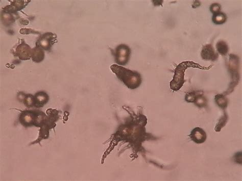 Ammonium Biurate Crystals In Urine Cat at Matilda Howard blog