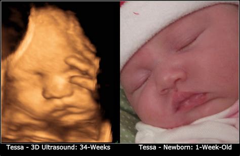 Mommy Said So 3D Ultrasound Photo Side-by-Side Comparison to My Actual Newborn Baby