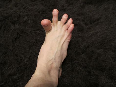Toe Cramps At Night