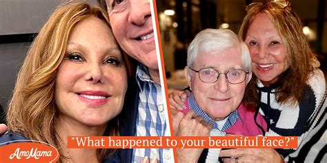 Marlo Thomas Face Surgeries