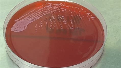 Staphylococcus epidermidis- Introduction, Morphology, Pathogen
