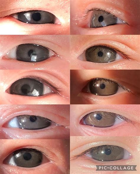 Newborn Eye Color Progression