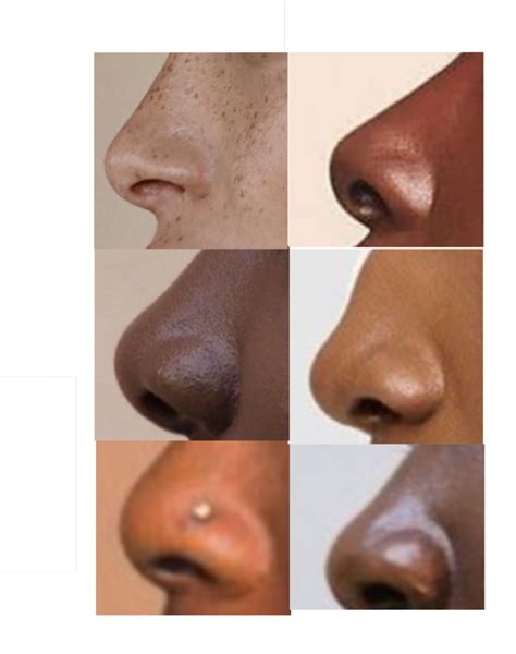 Nose Profile Pictures