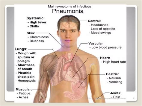 Pneumonia | PPSX