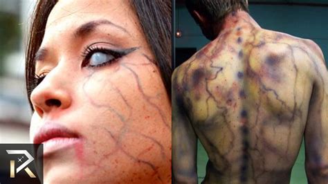 Most Lightning Strikes Man at Therese Arnold blog