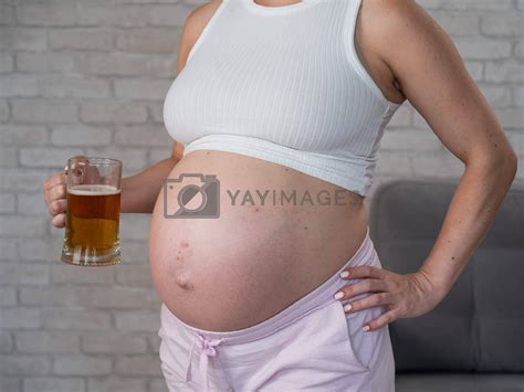 Faceless pregnant woman with rash on stomach holding glass of beer. by ...