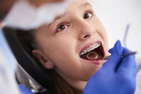 What Does An Orthodontist Do