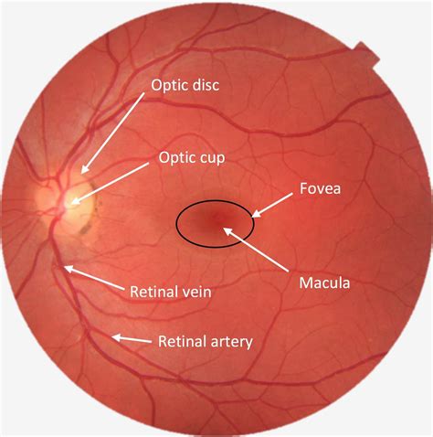 Eye Diagram Labeled Optic Disc at Larry Alvarez blog