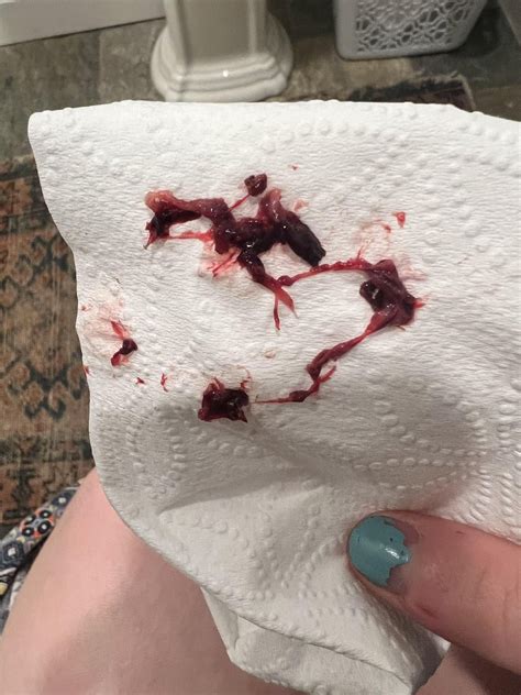 Normal period blood clot? [NSFW] : r/Periods