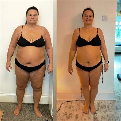 Dot's Weight Loss Success: 44lbs in 16 Weeks | Allurion Gastric Balloon ...