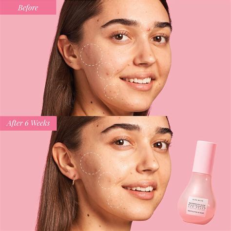 Glow Recipe Watermelon Niacinamide Dew Drops Serum | Ubuy India