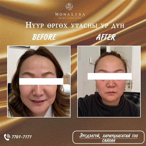 Mona Lisa Beauty Clinic Spa (@monalisa_clinic_) • Instagram photos and ...