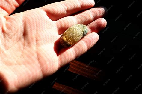 Premium Photo | Gallstone disease cholelithiasis the formation of stones stones in the ...