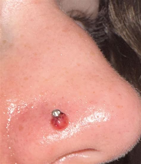 Nose Piercing Infection How To Tell If Your Nose Piercing Is Healed