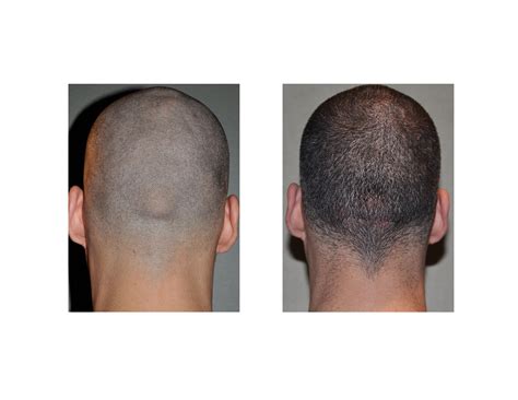 Why Is There A Dip In My Head at Margaret Newsom blog