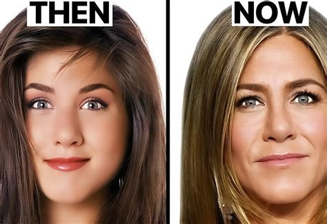 Bradley Cooper Face Surgery