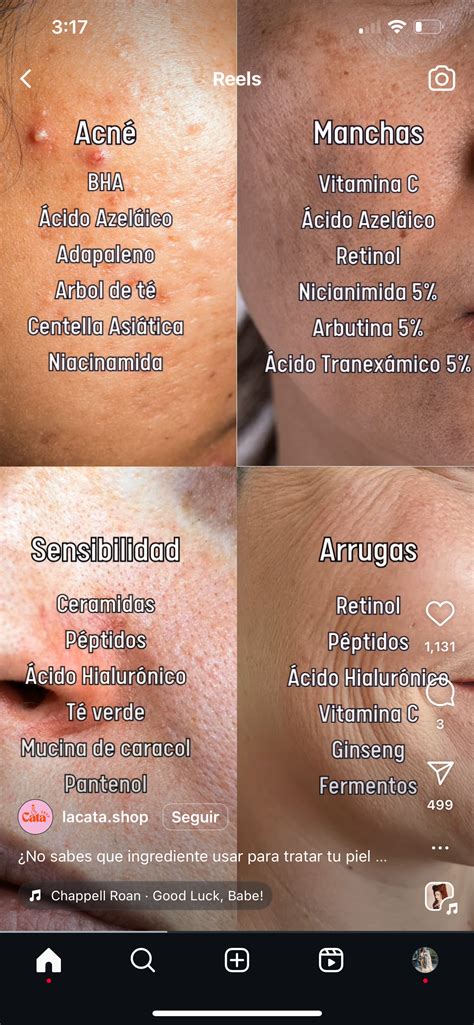 Pin de Tori en cuidado personal en 2025 | Estetica de belleza, Cremas para el acne, Productos ...