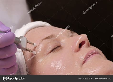 Cosmetic procedure for the rejuvenation of the skin with the use of ...